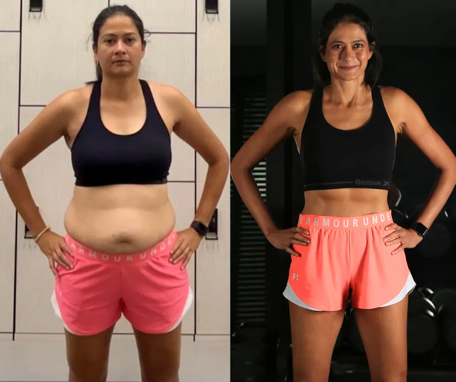 Synedica Retatrutide before and after weight loss result 1 (-16 kg · 90 days)