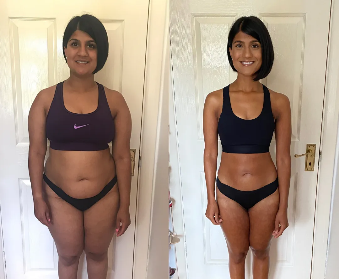Synedica Retatrutide before and after weight loss result 2 (-17 kg · 120 days)