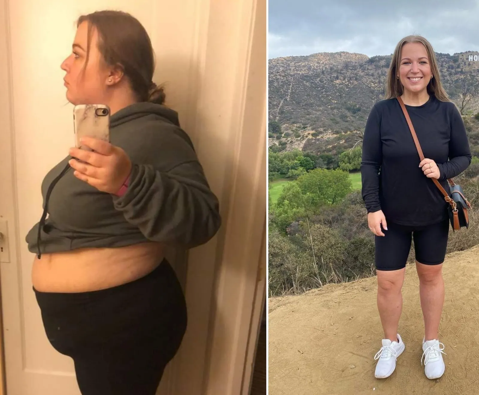Synedica Retatrutide before and after weight loss result 8 (-24 kg · 100 days)